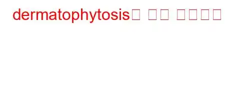 dermatophytosis은 무슨 뜻인가요